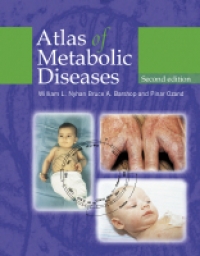 Atlas of Metabolic Diseases Second edition